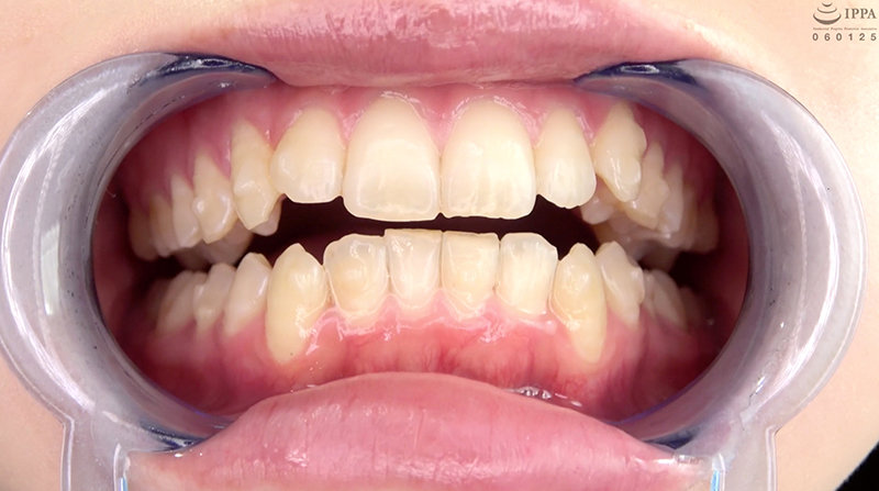 AD-668 第 10 部分 - 30 分钟