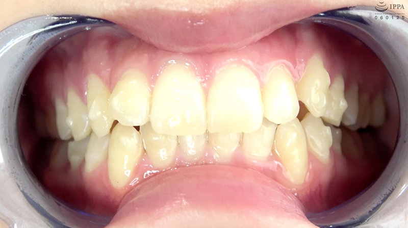 AD-668 第 3 部分 - 30 分钟