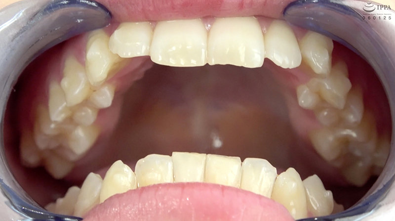 AD-668 第 5 部分 - 30 分钟