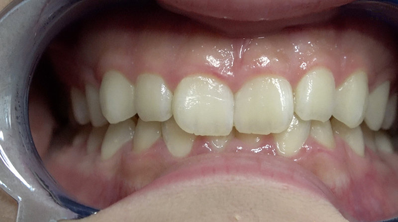 AD-673 第 6 部分 - 30 分钟