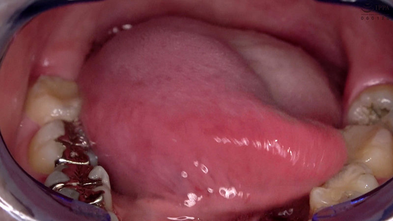 AD-692 Part 12 - 30 minutes