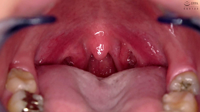 AD-692 Part 14 - 30 minutes