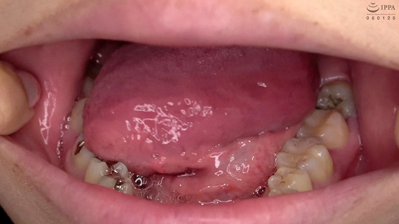 AD-692 Part 16 - 30 minutes