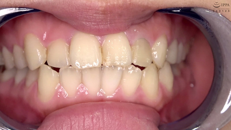 AD-692 Part 3 - 30 minutes