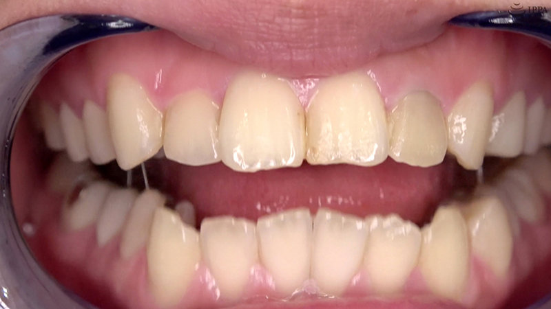 AD-692 Part 4 - 30 minutes