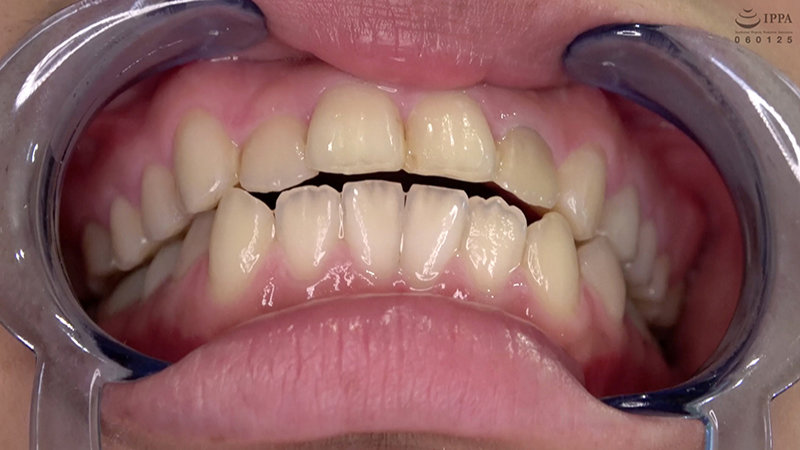 AD-692 Part 6 - 30 minutes