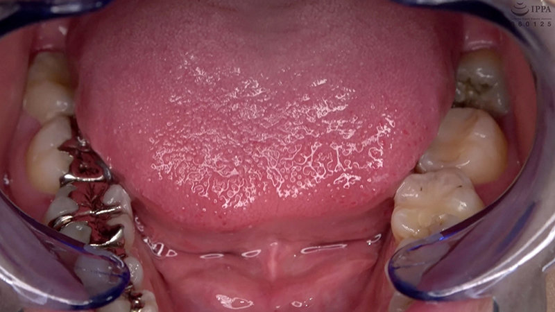 AD-692 Part 8 - 30 minutes