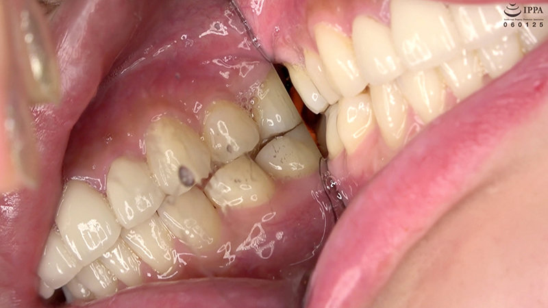 AD-700 Part 10 - 30 minutes