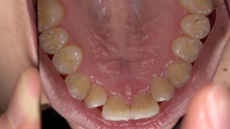 AD-753 Part 11 - 30 minutes