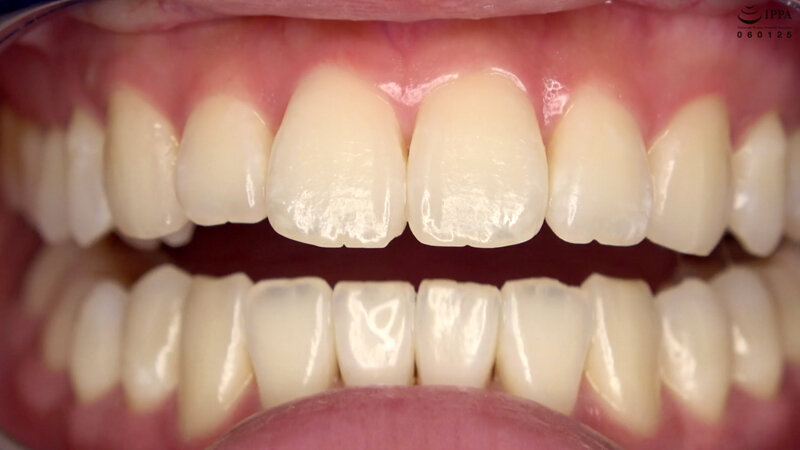 AD-759 Bagian 6 - 30 minit