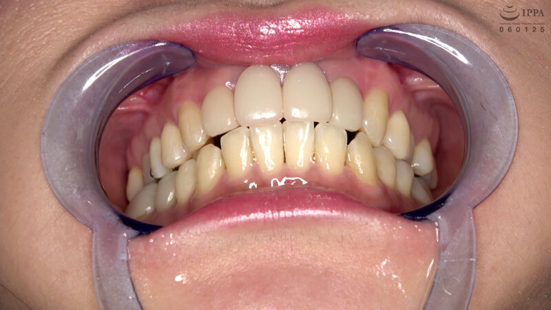 AD-786 第 10 部分 - 30 分钟