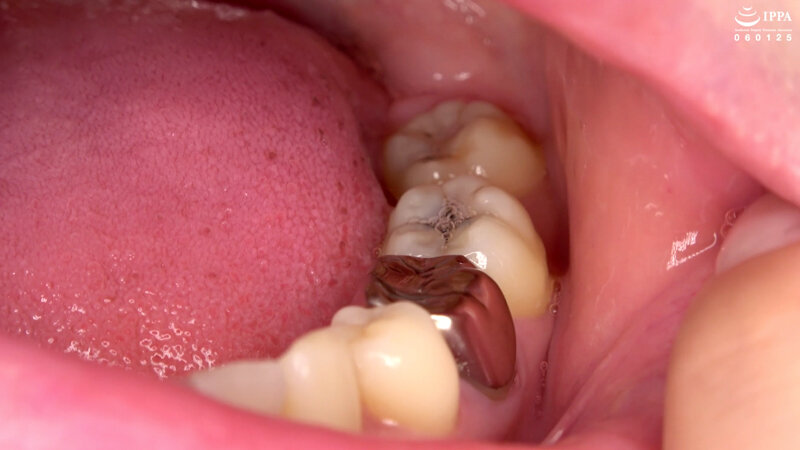 AD-851 第 11 部分 - 30 分钟