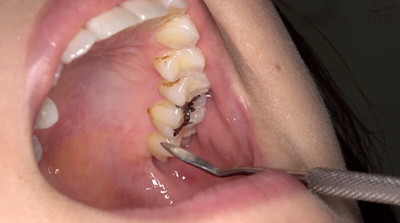 AD-900 Part 9 - 30 minutes