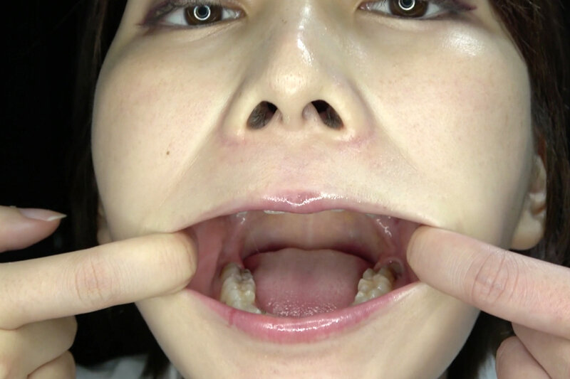 AD-923 Part 11 - 30 minutes