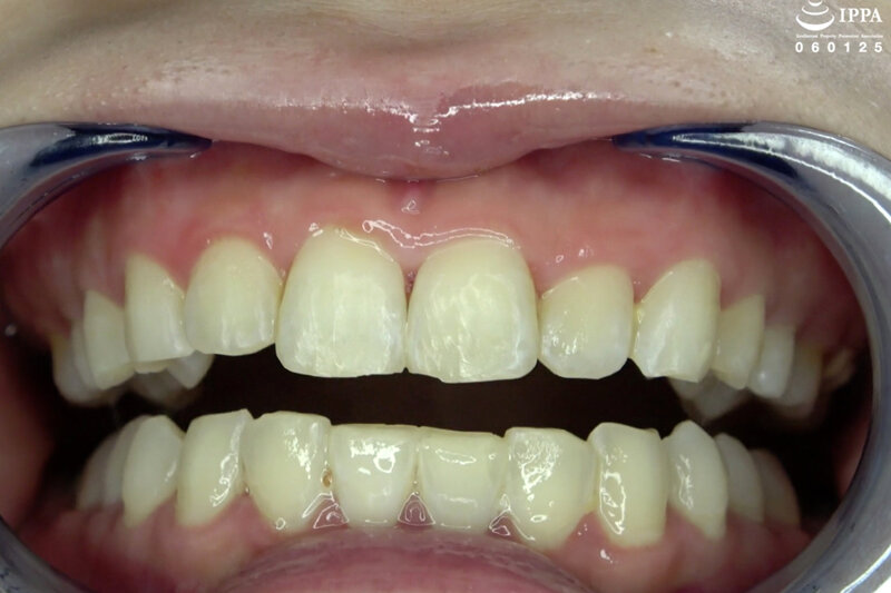 AD-923 Part 7 - 30 minutes