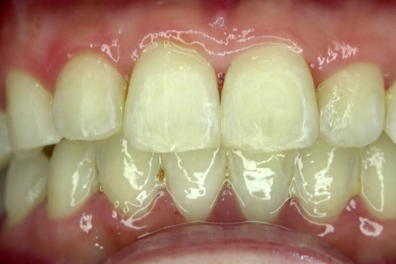 AD-923 Part 8 - 30 minutes