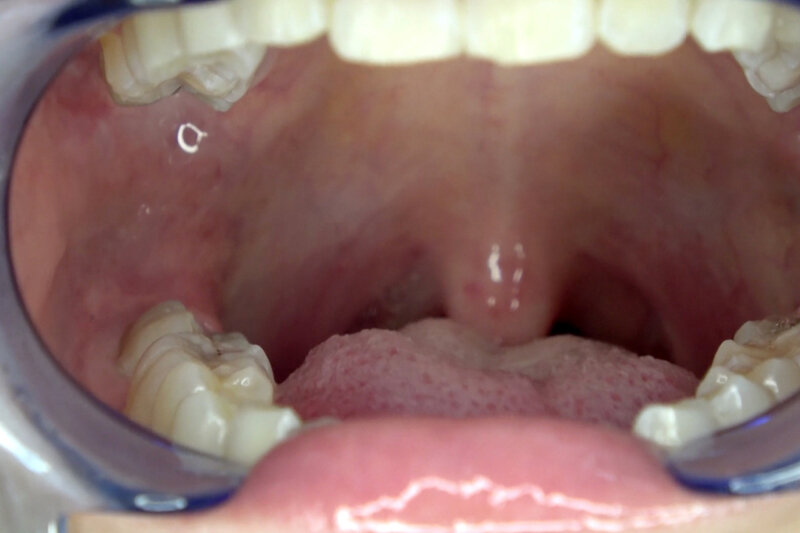 AD-923 Part 9 - 30 minutes