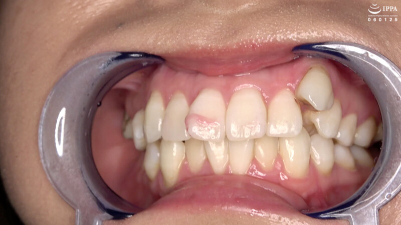 AD-956 Part 11 - 30 minutes