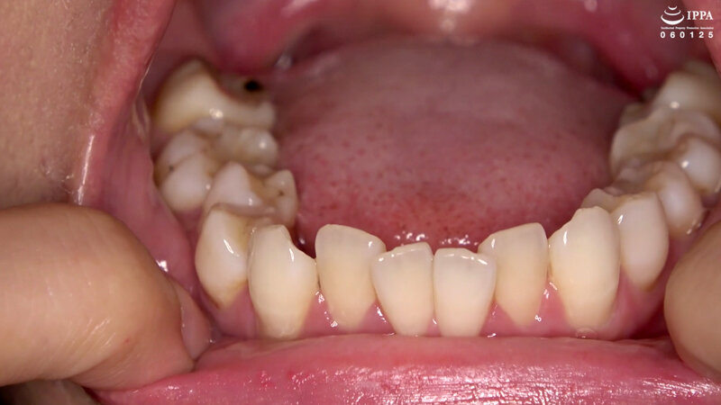 AD-956 Part 13 - 30 minutes