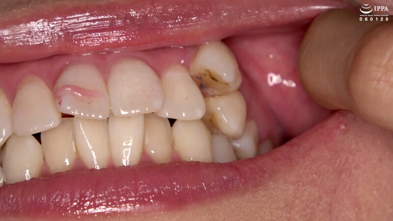 AD-956 Part 15 - 30 minutes