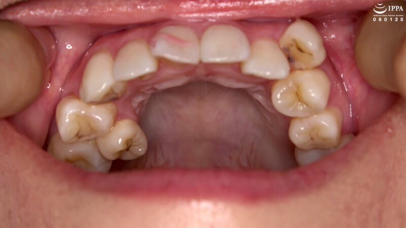 AD-956 第 16 部分 - 30 分钟