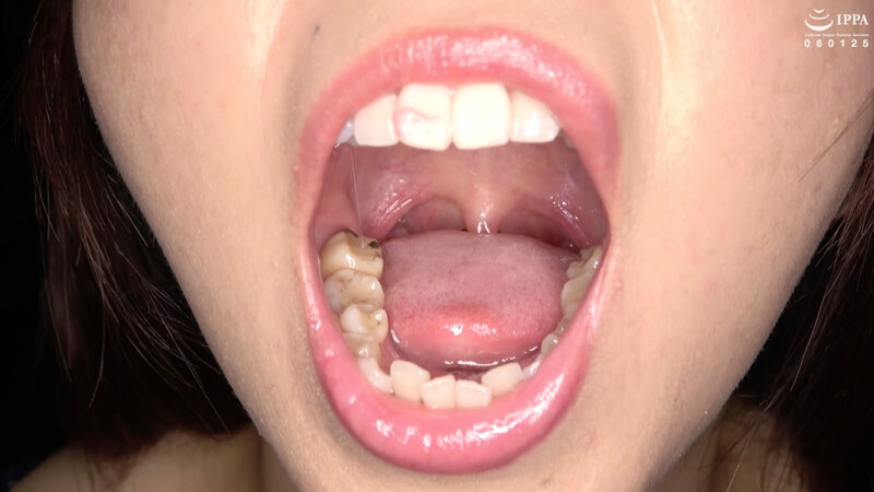 AD-956 第 5 部分 - 30 分钟