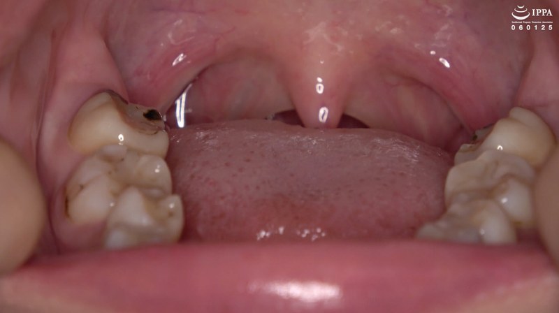 口内・歯・のどちんこ観察 堂本未來