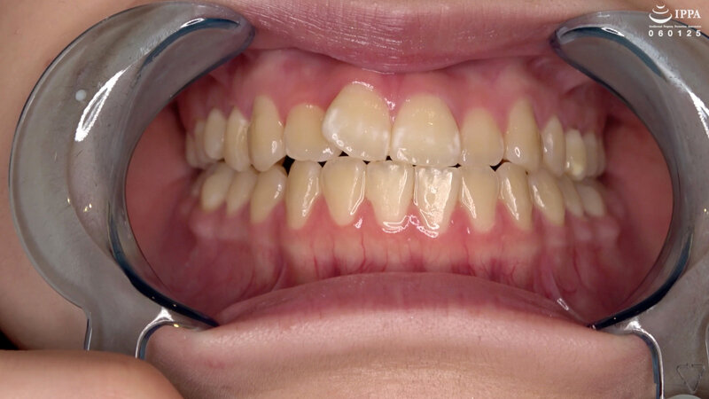 AD-01017 第 8 部分 - 30 分钟