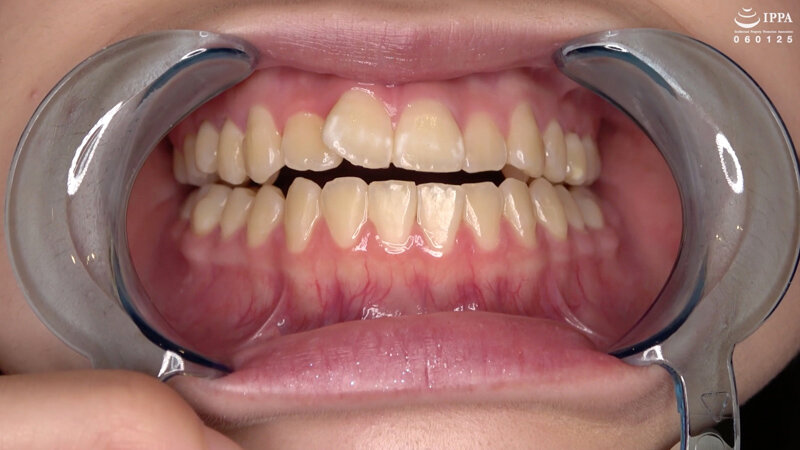 AD-01017 第 9 部分 - 30 分钟