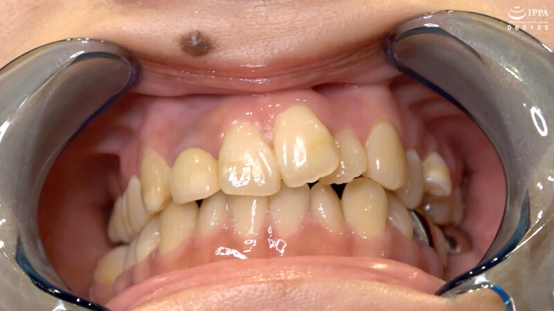 AD-01150 パート 10 - 30 分