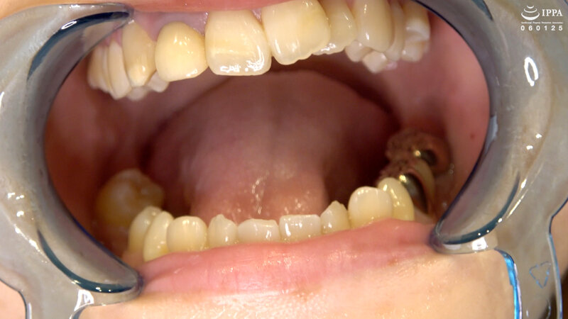 AD-01150 パート 8 - 30 分