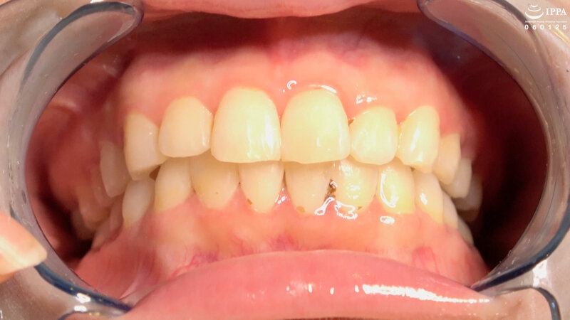 AD-01227 Part 8 - 30 minutes