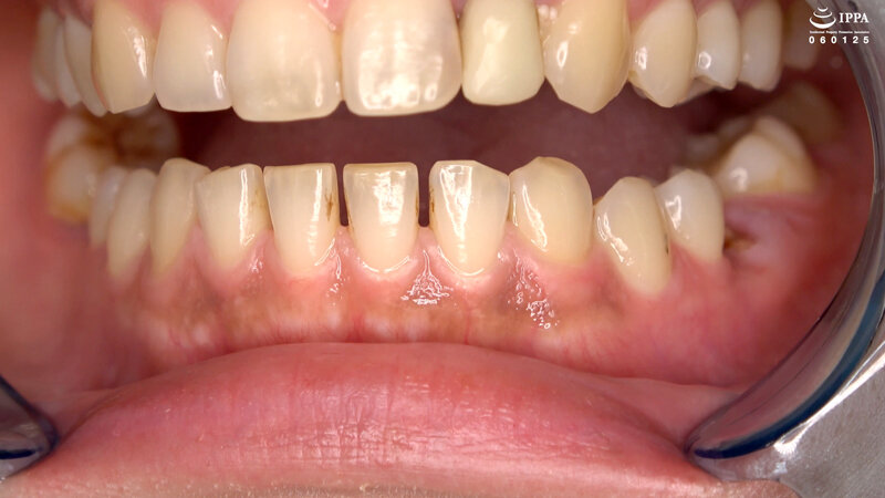 AD-01242 第 10 部分 - 30 分钟