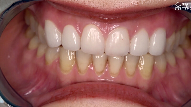 AD-01294 パート 4 - 30 分