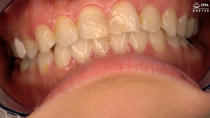 AD-01320 Part 4 - 33 minutes