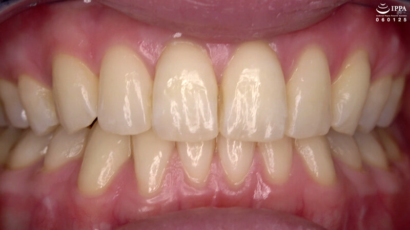 AD-01411 第 10 部分 - 30 分钟