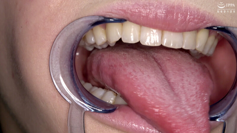 AD-01411 第 11 部分 - 30 分钟