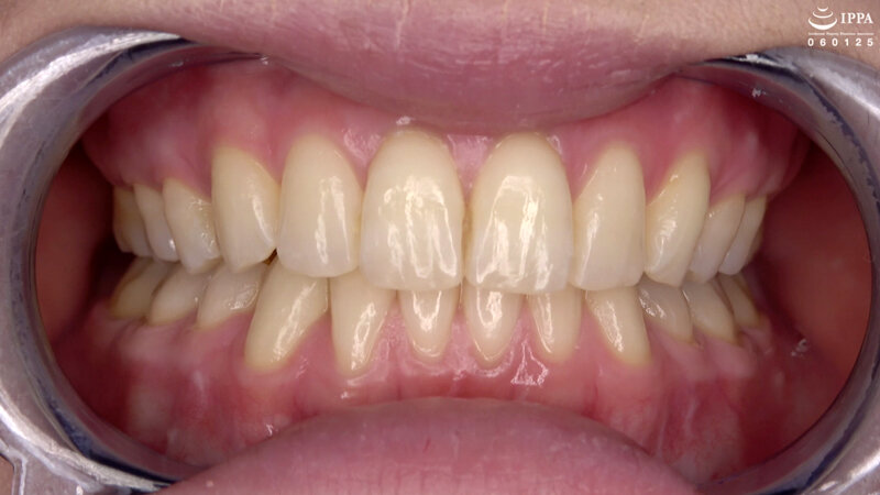 AD-01411 Part 9 - 30 minutes