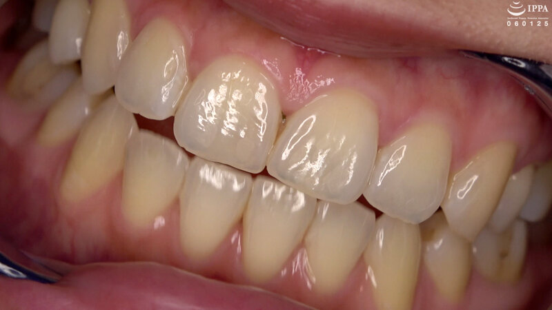 AD-01421 第 14 部分 - 30 分钟