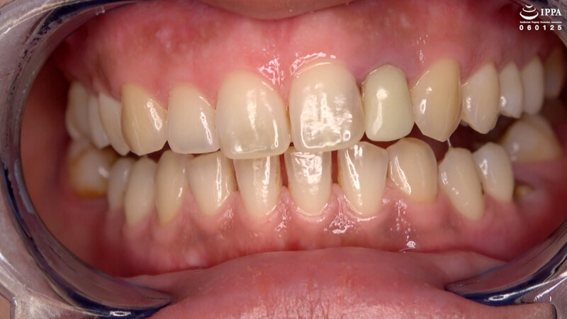 AD-01504 Bagian 11 - 30 minit