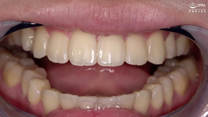 AD-01525 Bagian 4 - 33 minit