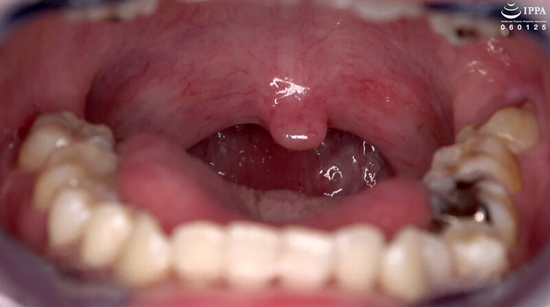 AD-01536 パート 10 - 30 分