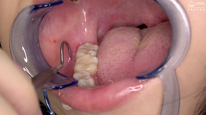 AD-01536 Part 11 - 30 minutes