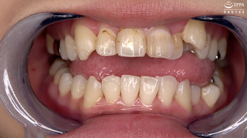 AD-01536 パート 3 - 30 分