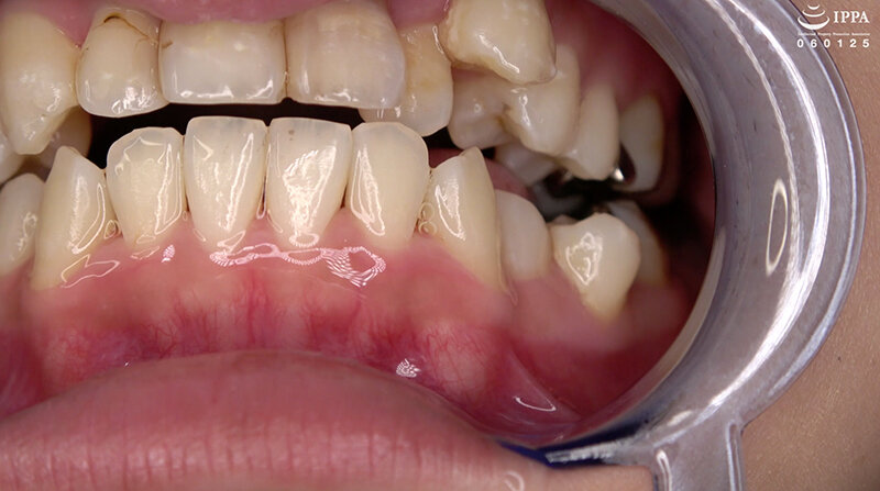 AD-01536 パート 5 - 30 分