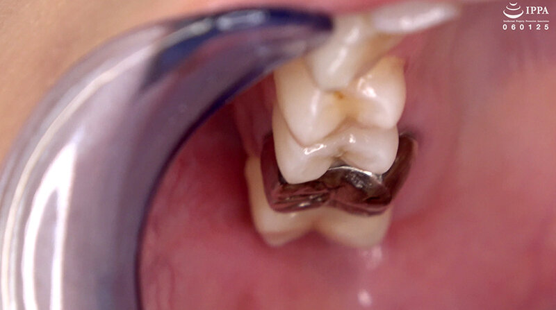 AD-01536 パート 8 - 30 分