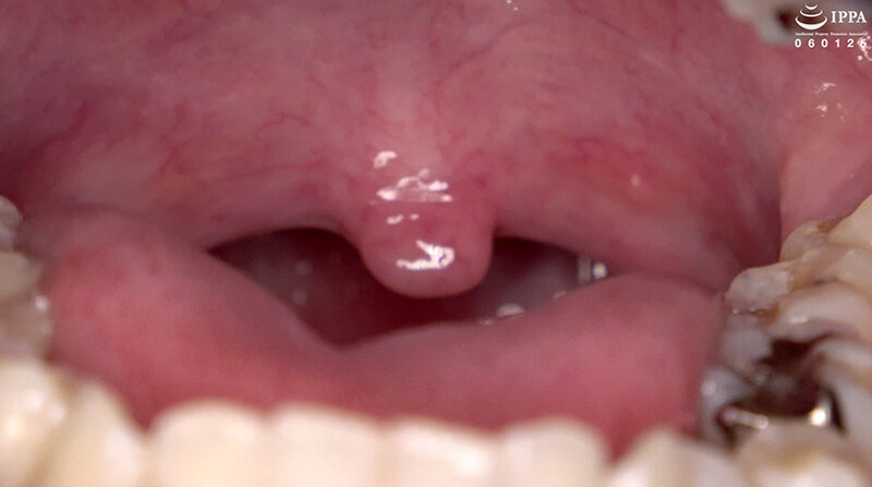 AD-01536 パート 9 - 30 分