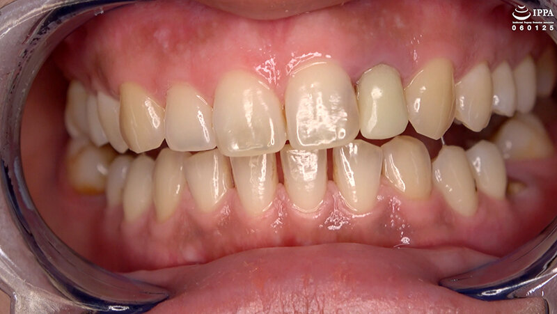 AD-01552 パート 11 - 30 分