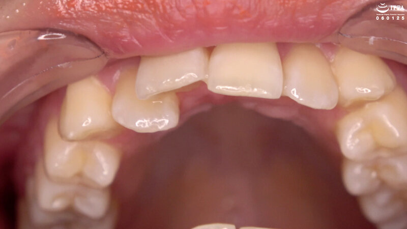 AD-01603 第 9 部分 - 30 分钟