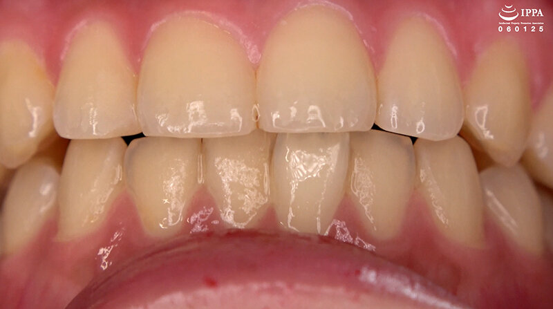 AD-01665 パート 6 - 30 分